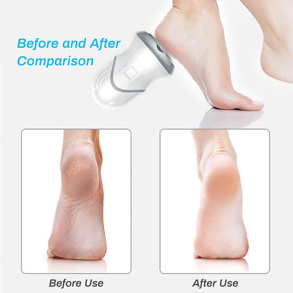 Rechargeable Foot File and Callus Remover